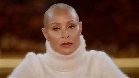 Jada Pinkett Smith Opens Up About Oscars Slap Struggles With Alopecia