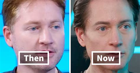 Biotech Ceo Who Used Sons Blood To Reverse Aging” Says Hes