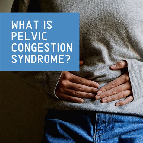 What Is Pelvic Congestion Syndrome New York City Fibroid Center