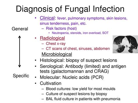 What is fungal infection in skin: Fungal infections: Symptoms, types ...