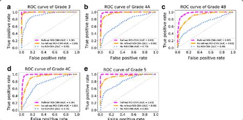 Roc Curve And Auc Values Of Different Implementations In Grading Breast Download Scientific