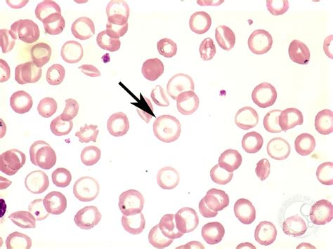 Target cell - 1.