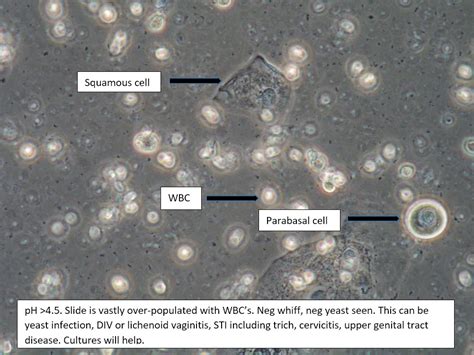 Candida Albicans Microscope Slide