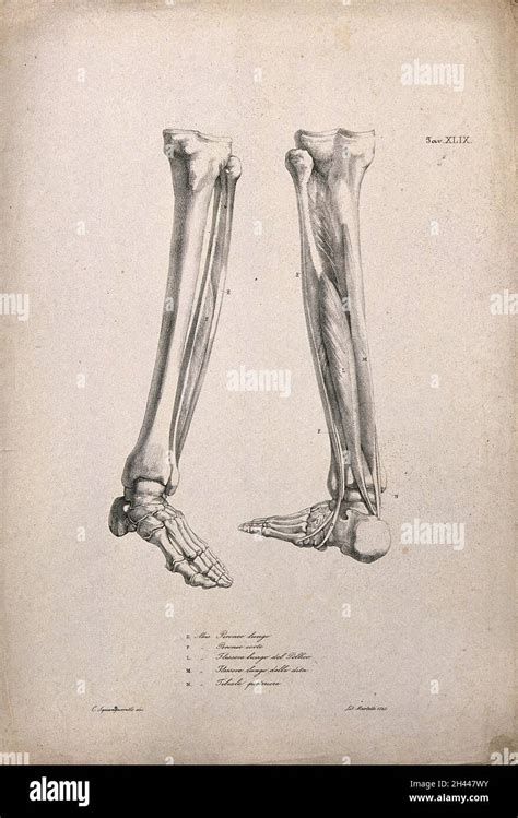 Bones And Muscles Of The Lower Leg Two Figures Of écorché Legs And Feet Lithograph By Martelli