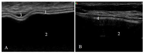 Medicina Free Full Text The Value Of Ultrasound In The Evaluation