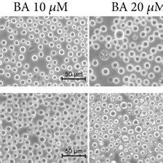 Ba Changed The Morphology And Inhibited The Proliferation Of Mm Cells