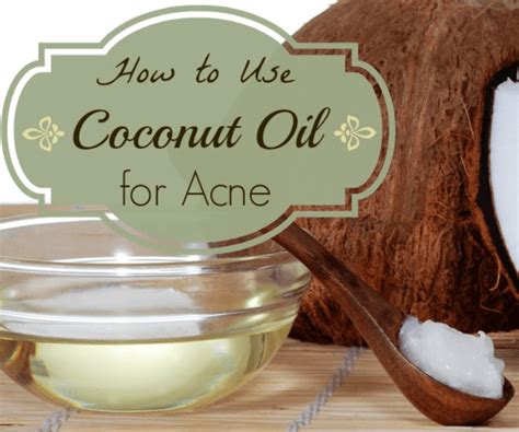 How to Use Coconut Oil for Acne Treatment