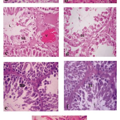 A Cross Section Of The Testis Of Control Rat Showing The Seminiferous