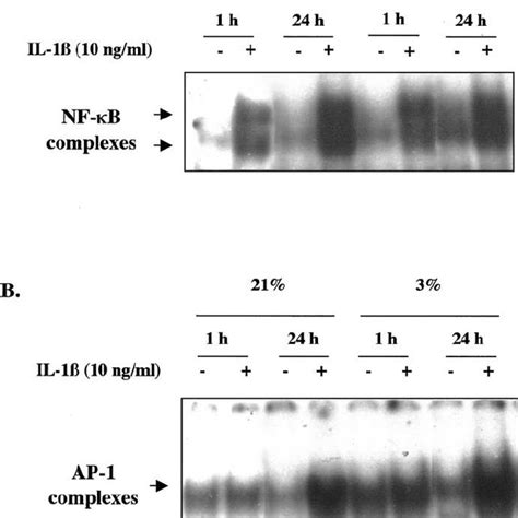 Effect of IL 1 β treatment on NF κ B and AP 1 DNA binding activity in