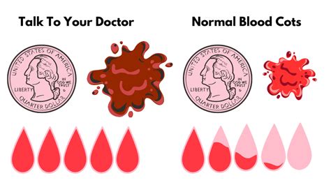 Is It Normal to Have Menstrual Clots During Your Period?