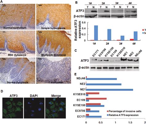 Expression Of Atf In Escc Tissues And Escc Cell Lines A Expression