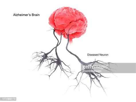 Damaged Neurons Foto E Immagini Stock Getty Images