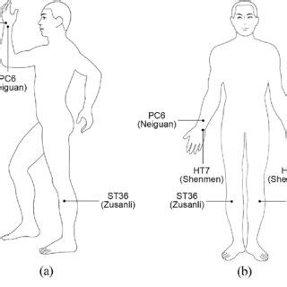 Location of Shenmen (HT7), Neiguan (PC6) and Zusanli (ST36) acupoints.... | Download Scientific ...