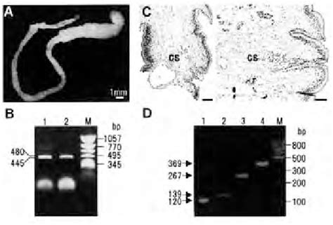 Sparganosis And Diphyllobothriasis A And B A Formalin Fixed