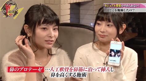 一卵性の双子アイドル、美容整形のきっかけは「また似てるねって言われたくて」 国内 Abema Times アベマタイムズ