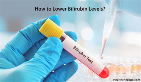 How To Lower Bilirubin Levels Symptoms Causes Of High Bilirubin Levels