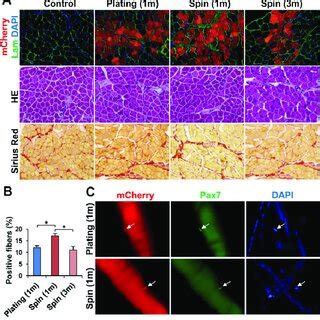 In Vivo Myogenic Differentiation Of Primary Myoblasts After Plating And