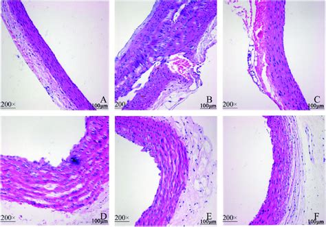 Comparison Of Pathological Morphology Of The Aorta Of The Rat