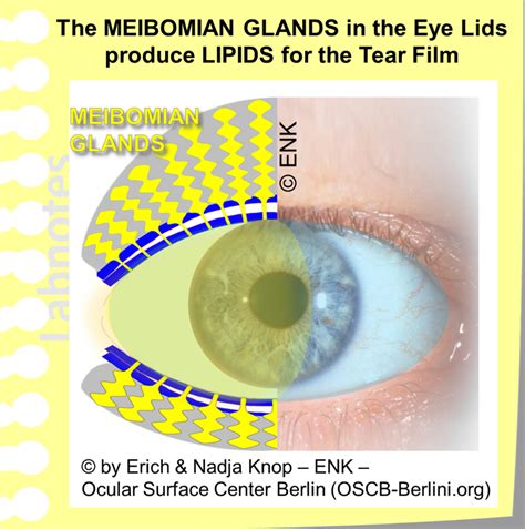 Normal Meibomian Glands