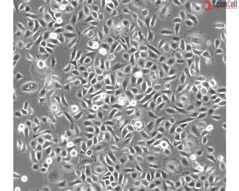 Human Small Airway Epithelial Cells Hpsaepic