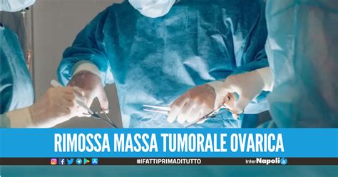 Intervento Record All Ospedale Di Salerno Rimosso Tumore Di Chili Ad