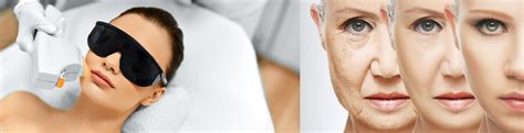 Anti Aging Treatment | Skin Rejuvenation Treatment In Lahore