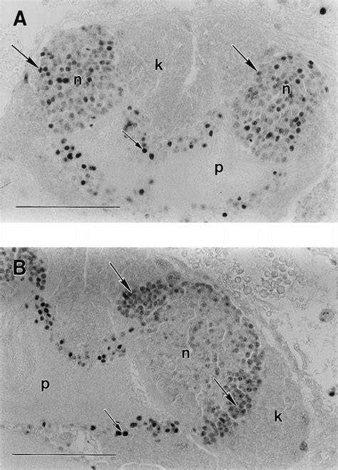 5 Bromo 2 Deoxyuridine Brdu Labeled Neuroblast Clusters In The