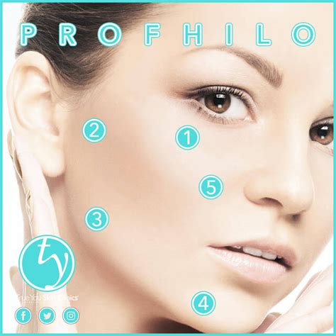 Rediscover Your Skin S Radiance With Our Profhilo Treatment Artofit