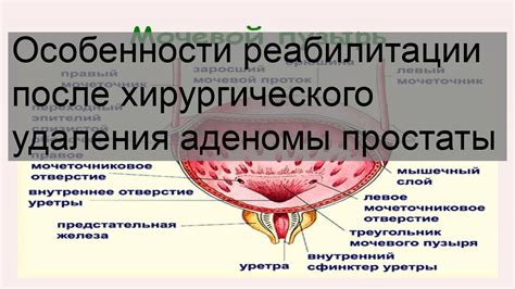 Особенности реабилитации после хирургического удаления аденомы простаты ...
