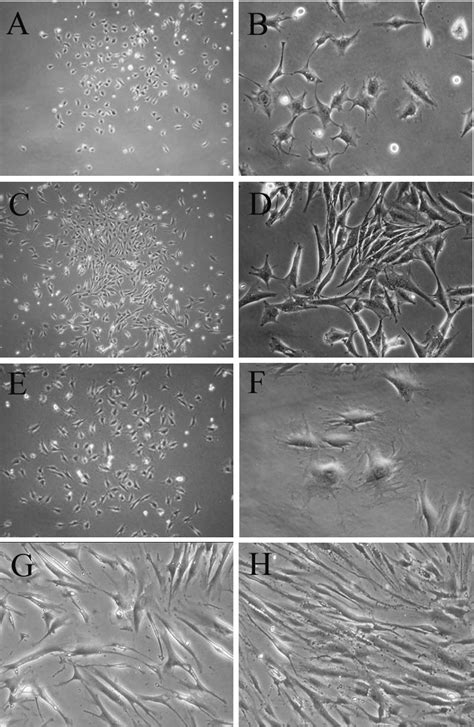 Cell Morphology Of Human Dental Follicle Hdf Stem Cells Hdf Cells