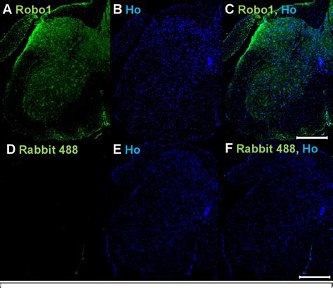 Figure From The Role Of Slit Robo Signalling In Peripheral Nerve