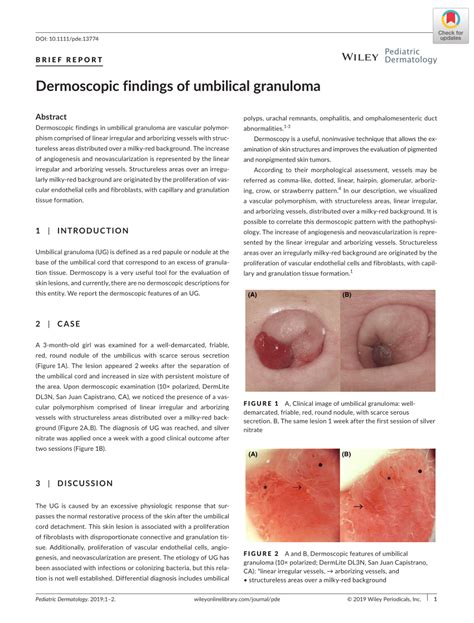 Umbilical Granuloma Vs Polyp