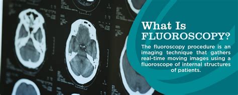 What Is Fluoroscopy And How To Prepare Envision Radiology