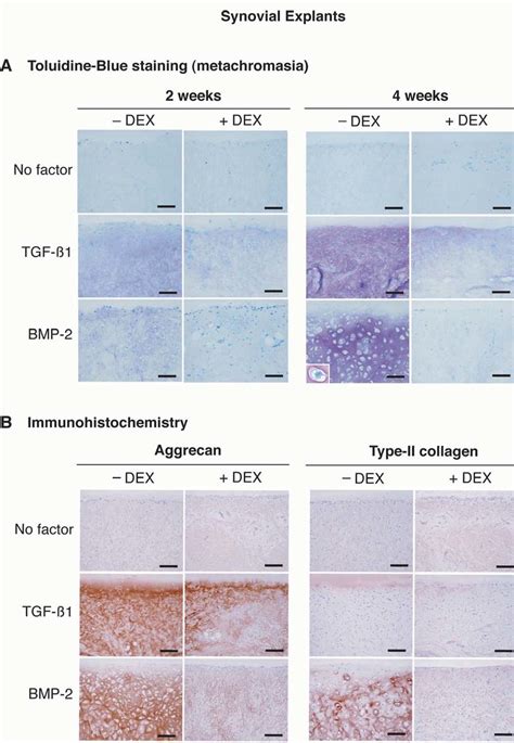 Dex Inhibits The Tgf β1 And Bmp 2 Induced Deposition Of Gags A B And