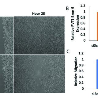 Pvt Regulates Migration Of Mda Mb Cl Tnbc Cells A Wound Healing