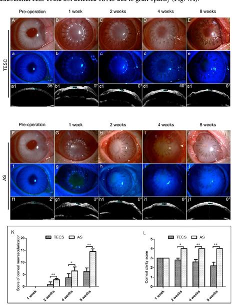 Construction Of Tissue Engineered Full Thickness Cornea Substitute Using Limbal Epithelial Cell