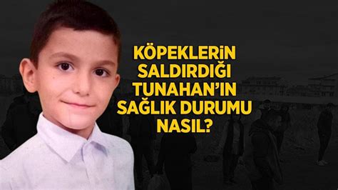 ankarada koepeklerin saldirisinda yaralanan  yasindaki tunahan icin