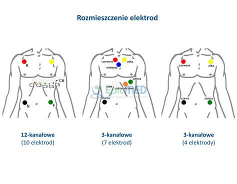 Holter Ekg Aspekt Hlt Program Holcard Alfa Epicmed