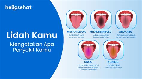 Arti Warna Lidah Mulai Dari Yang Normal Hingga Tak Sehat Hellosehat