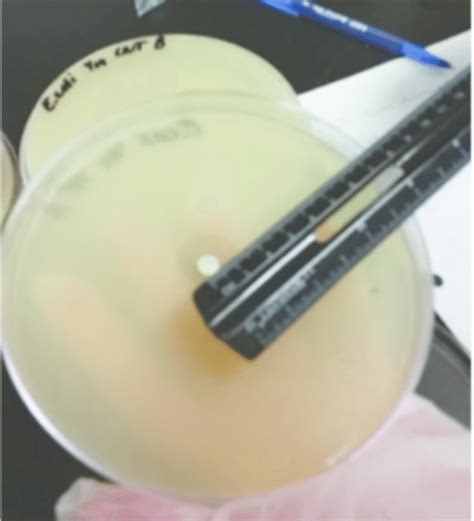 Zone Of Inhibition ZOI Measurements The ZOI For Each Organism Versus