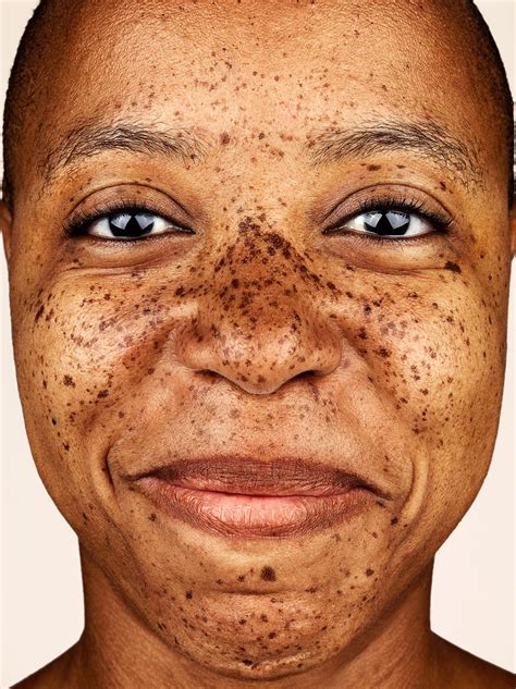 Freckles Photography Exhibition Sweden By Photographer Brock Elbank