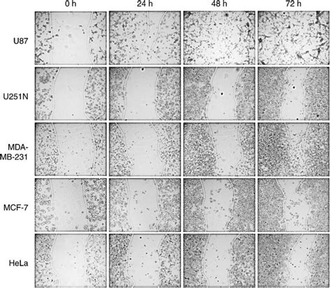 Cancer cell migration using ring cell migration assay. Cells (250,000... | Download Scientific ...