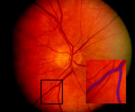 Retinal Vascular Imaging Circulation Cardiovascular Imaging