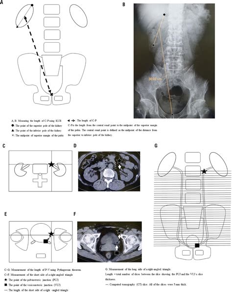 Scielo Brasil Simplified Method Using Kidney Ureter Bladder X Ray