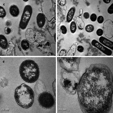 Transmission Electron Microscopy Of Iptg Induced E Coli Bl21de3