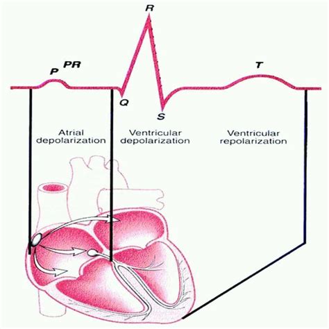 EKG ECG MEDizzy