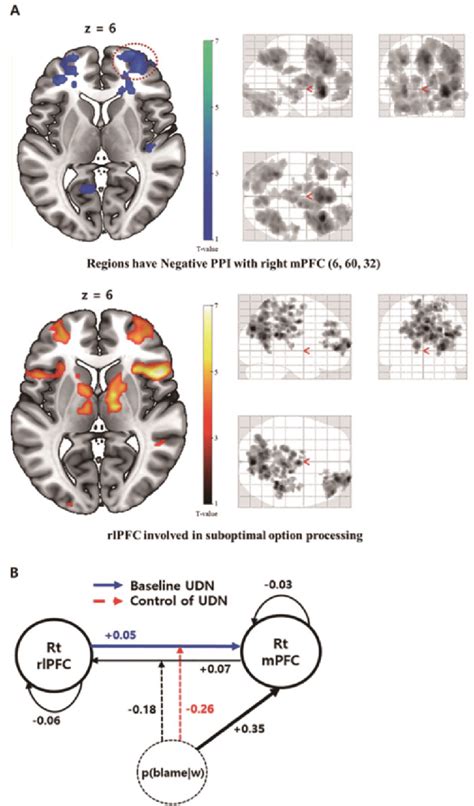 A Modulation Of Connectivity Between The Right Mpfc And Other Regions