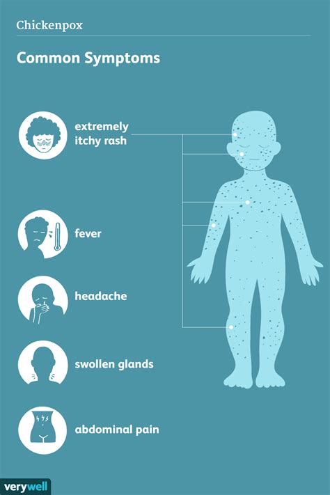 Shingles Vs Chickenpox