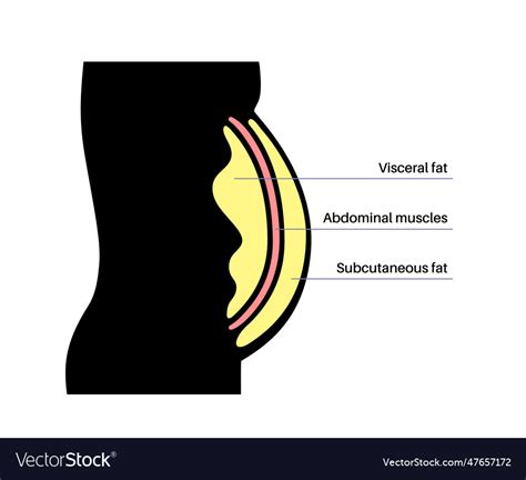 Visceral Fat Diagram Royalty Free Vector Image