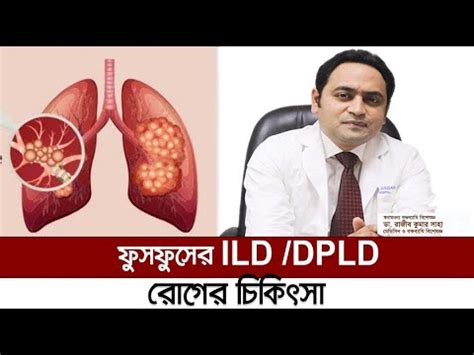 ফুসফুসের IDL/DPLD রোগের চিকিৎসা। স্বনামধন্য বক্ষব্যাধি বিশেষজ্ঞ ডা ...